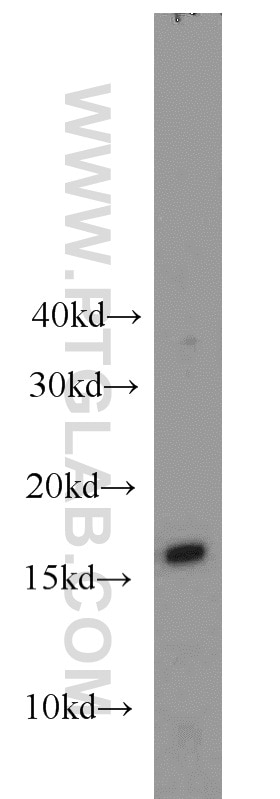 Western Blot (WB) analysis of UV treated HEK-293 using LC3B-Specific Polyclonal antibody (18725-1-AP)