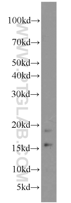 WB analysis of TN treated Hela using 18725-1-AP