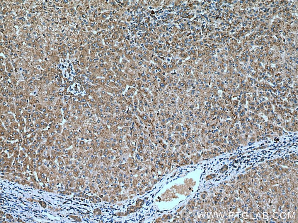 Immunohistochemistry (IHC) staining of human liver tissue using LC3C-Specific Polyclonal antibody (18726-1-AP)