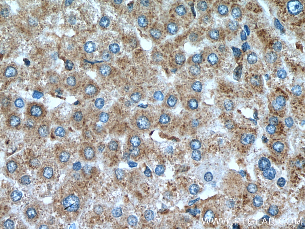 Immunohistochemistry (IHC) staining of human liver tissue using LC3C-Specific Polyclonal antibody (18726-1-AP)