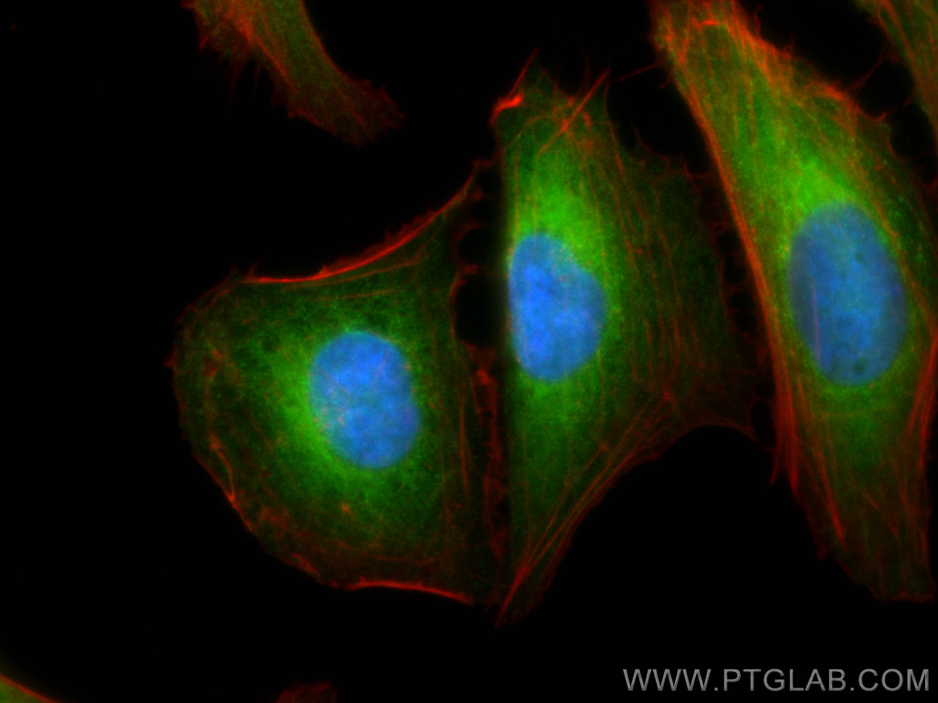 Immunofluorescence (IF) / fluorescent staining of U2OS cells using MAP1S Polyclonal antibody (15695-1-AP)