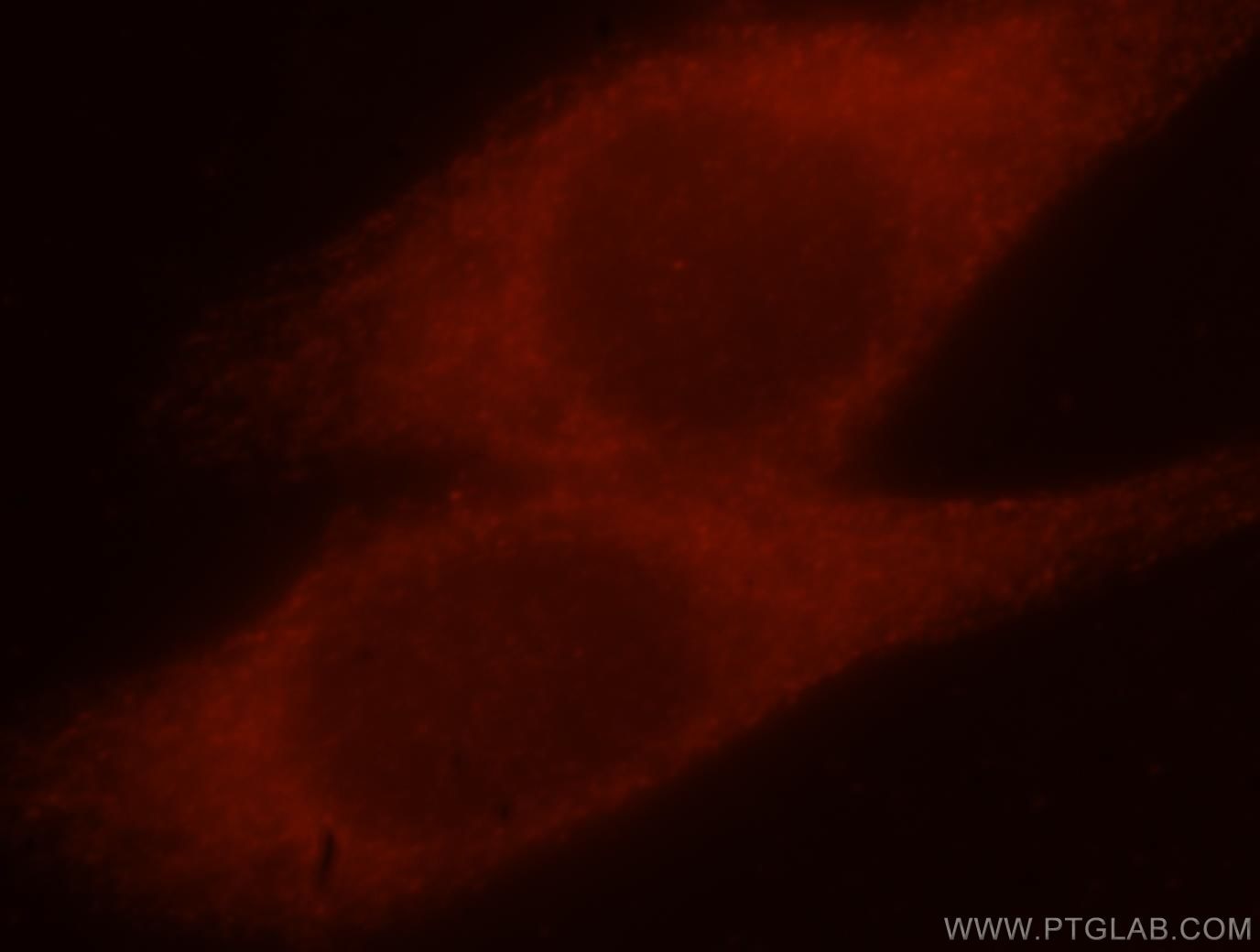 Immunofluorescence (IF) / fluorescent staining of HeLa cells using MAP1S Polyclonal antibody (15695-1-AP)