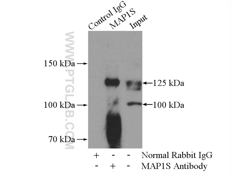 Immunoprecipitation (IP) experiment of SH-SY5Y cells using MAP1S Polyclonal antibody (15695-1-AP)