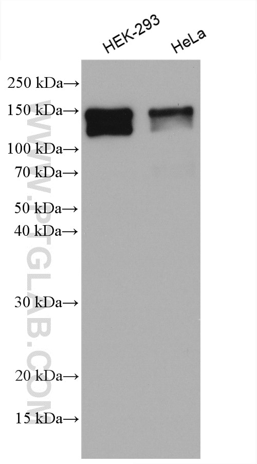 Western Blot (WB) analysis of various lysates using MAP1S Polyclonal antibody (15695-1-AP)