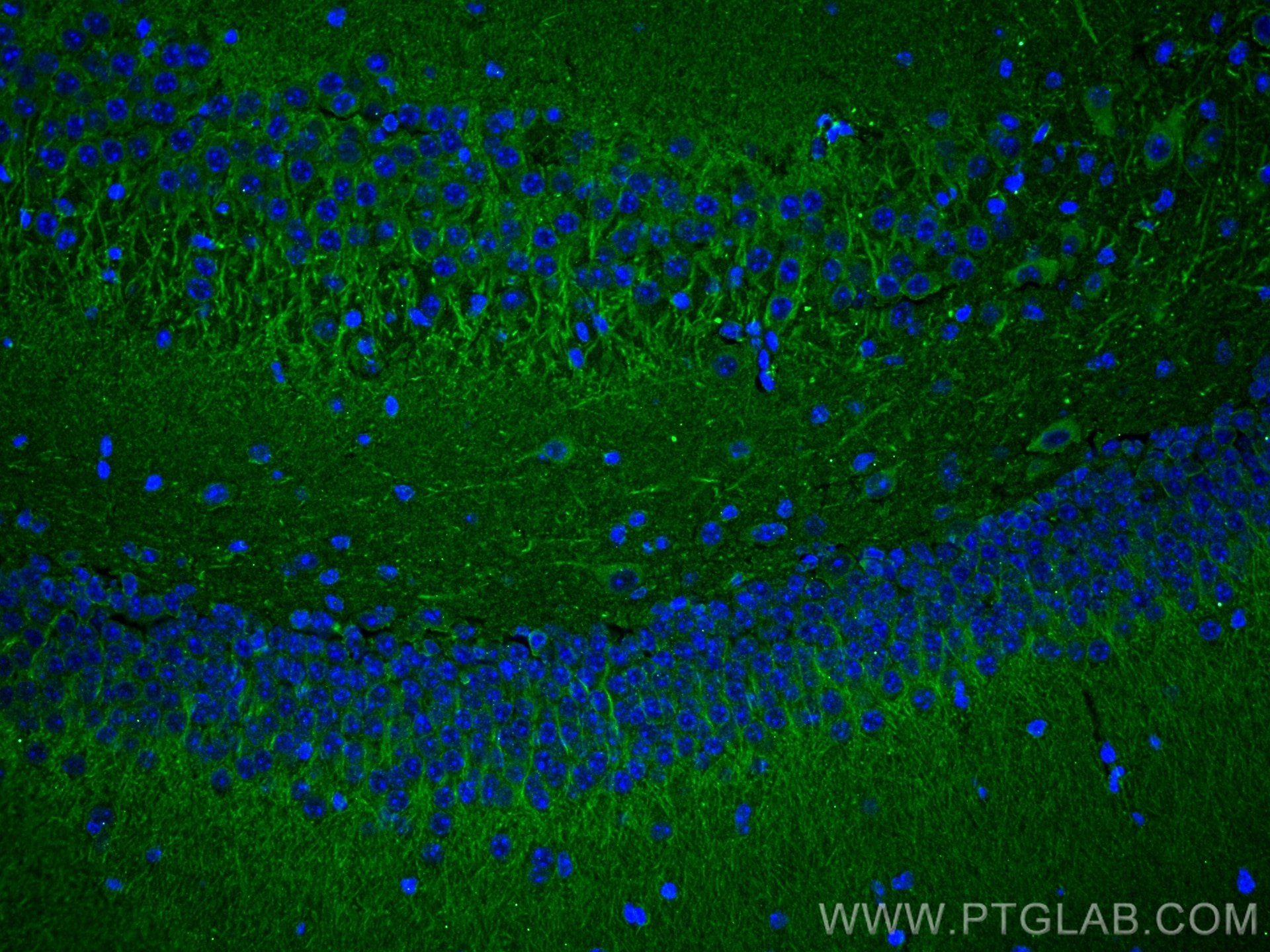 Immunofluorescence (IF) / fluorescent staining of mouse brain tissue using MAP2 Monoclonal antibody (67015-1-Ig)
