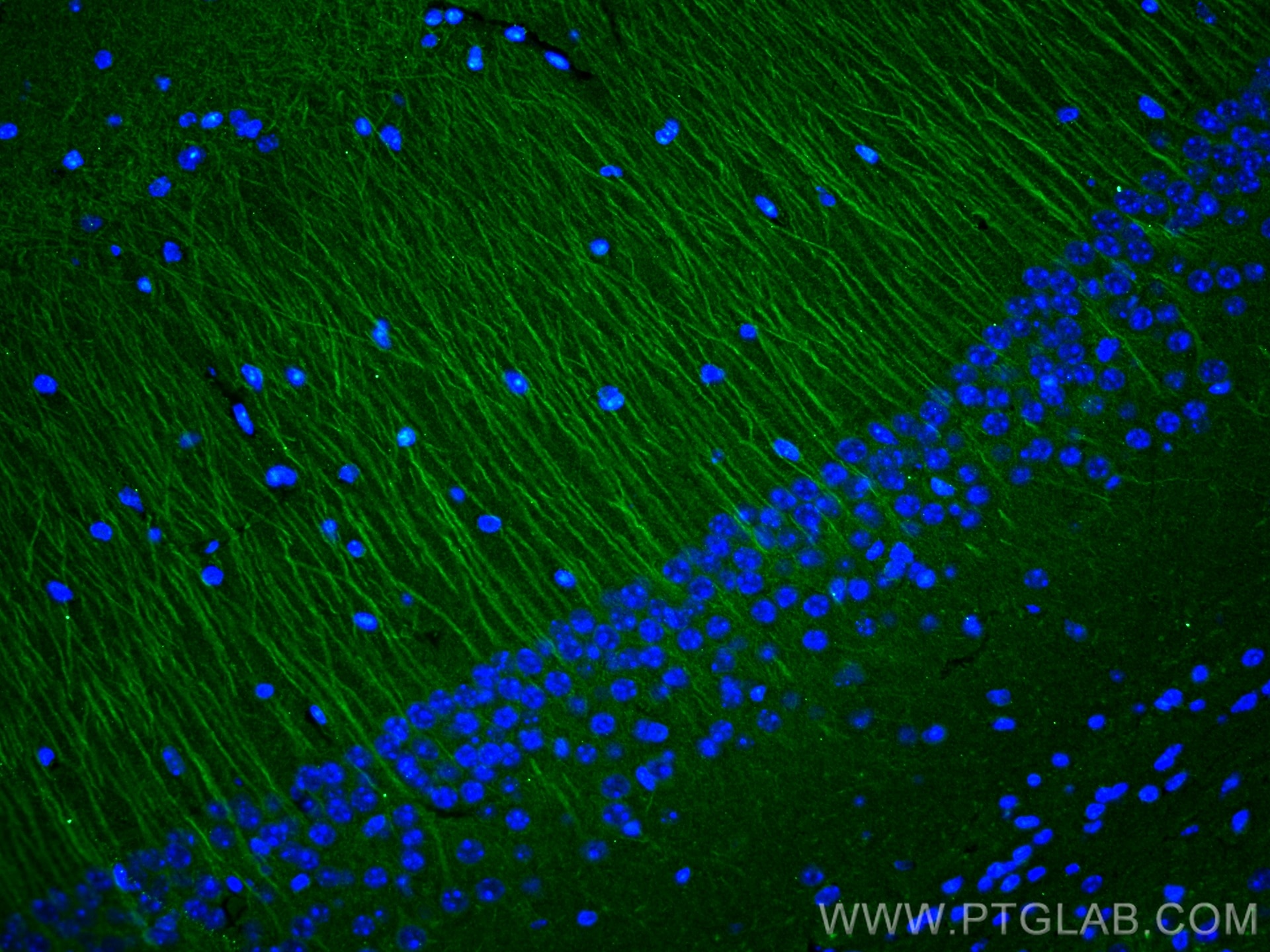 IF Staining of mouse brain using 67015-1-Ig