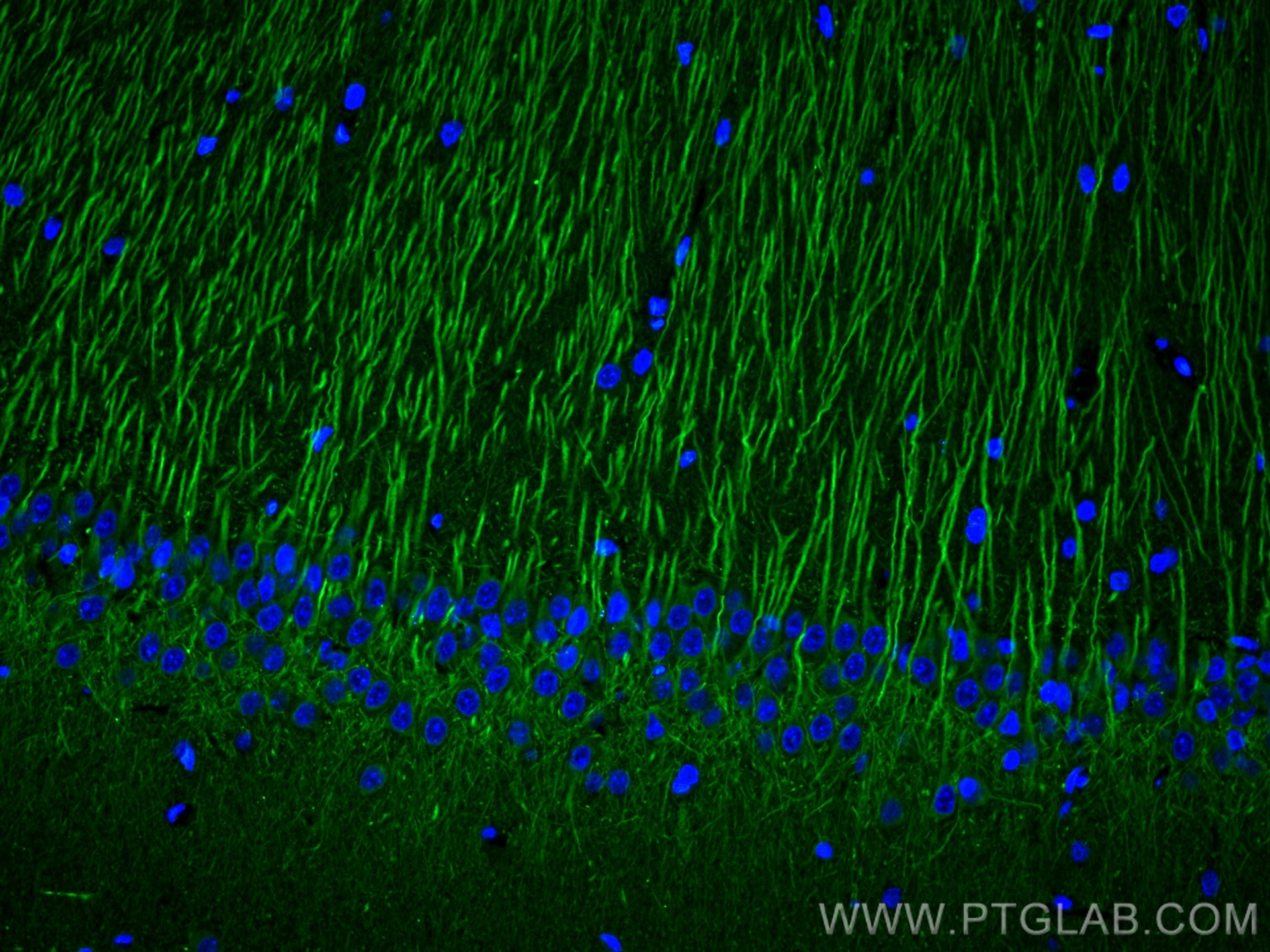 Immunofluorescence (IF) / fluorescent staining of rat brain tissue using MAP2 Monoclonal antibody (67015-1-Ig)