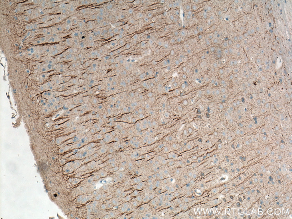 IHC staining of mouse brain using 67015-1-Ig