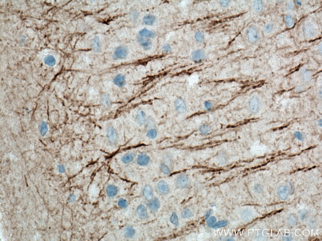 Immunohistochemistry (IHC) staining of mouse brain tissue using MAP2 Monoclonal antibody (67015-1-Ig)