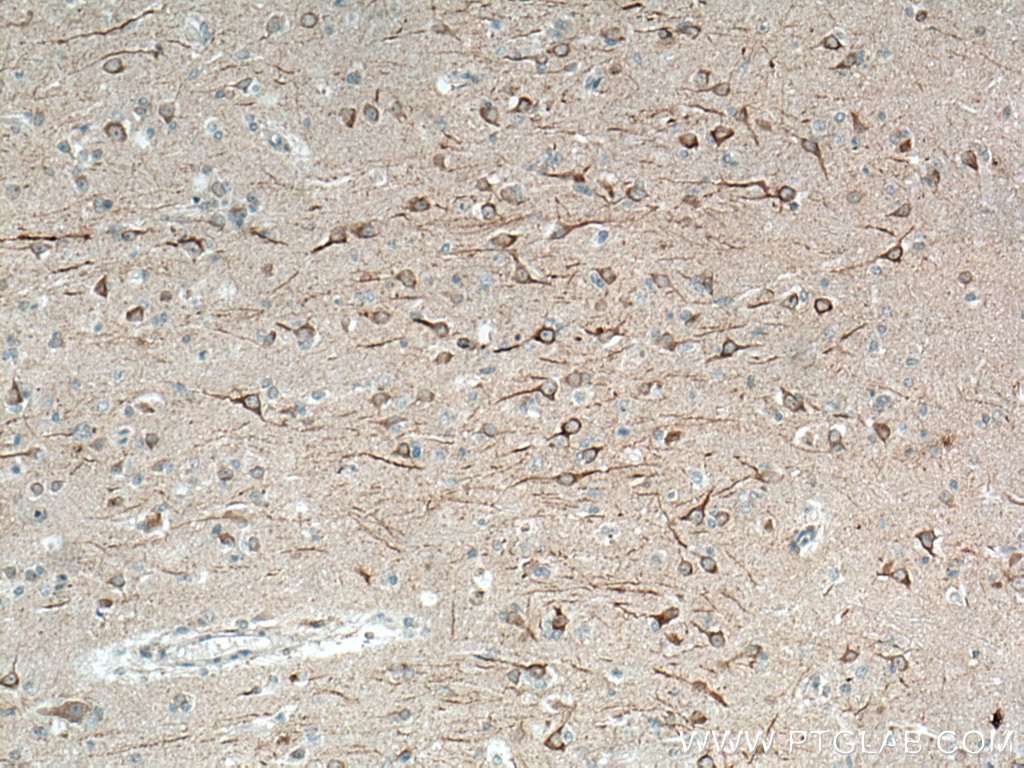 IHC staining of human brain using 67015-1-Ig