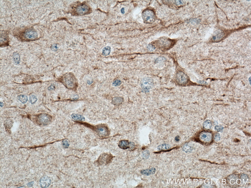 Immunohistochemistry (IHC) staining of human brain tissue using MAP2 Monoclonal antibody (67015-1-Ig)