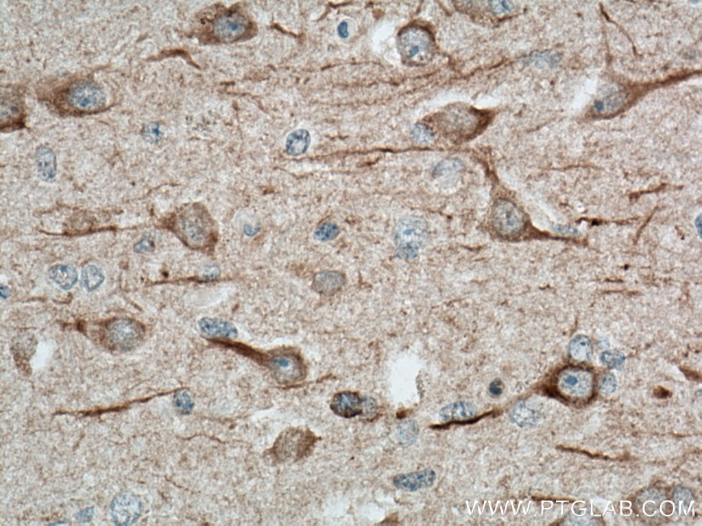 IHC staining of human brain using 67015-1-Ig