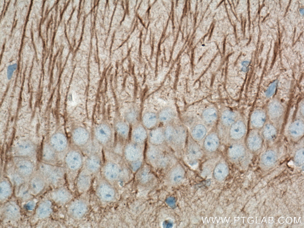 Immunohistochemistry (IHC) staining of mouse brain tissue using MAP2 Monoclonal antibody (67015-1-Ig)