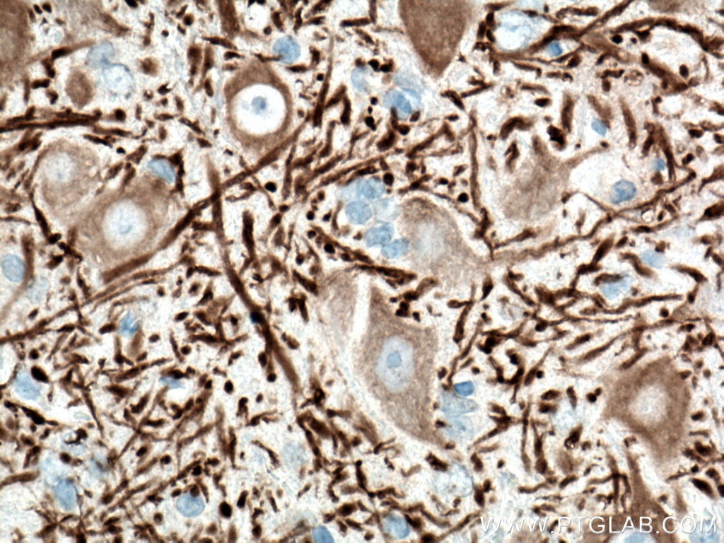 Immunohistochemistry (IHC) staining of mouse cerebellum tissue using MAP2 Monoclonal antibody (67015-1-Ig)