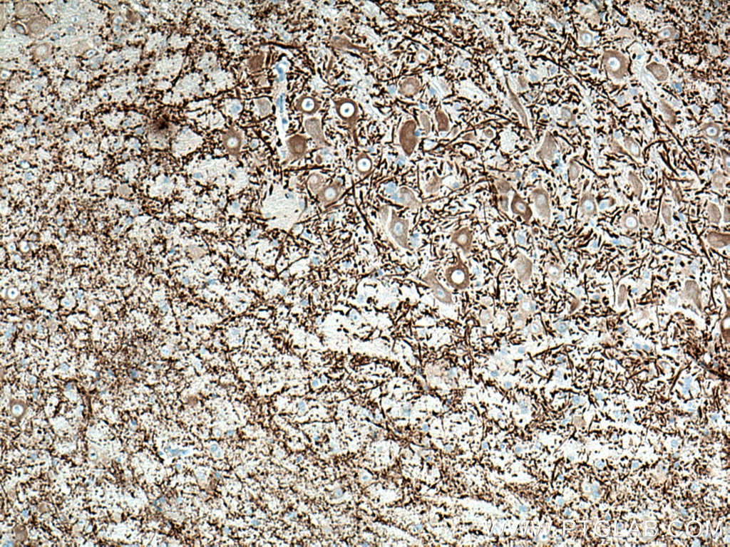 Immunohistochemistry (IHC) staining of mouse cerebellum tissue using MAP2 Monoclonal antibody (67015-1-Ig)