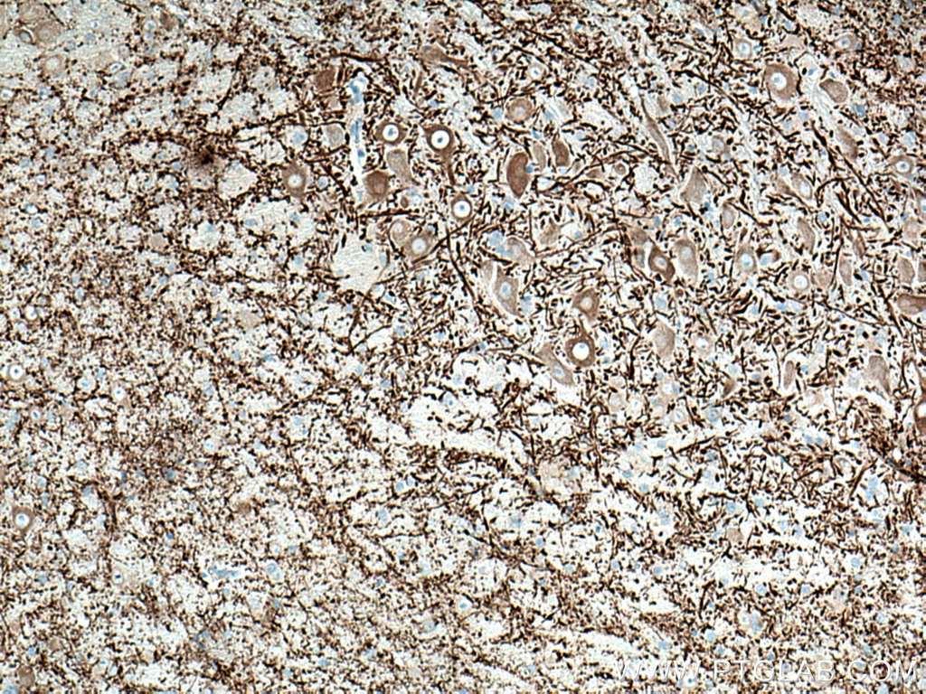 IHC staining of mouse cerebellum using 67015-1-Ig