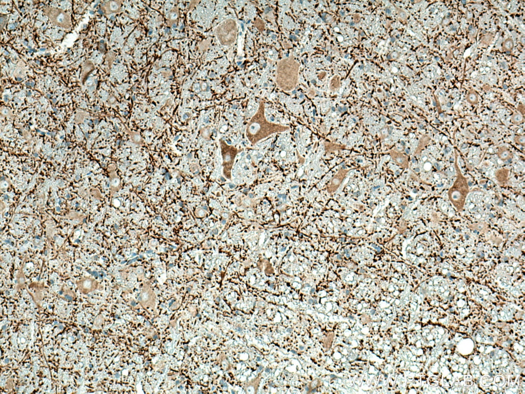 Immunohistochemistry (IHC) staining of rat cerebellum tissue using MAP2 Monoclonal antibody (67015-1-Ig)