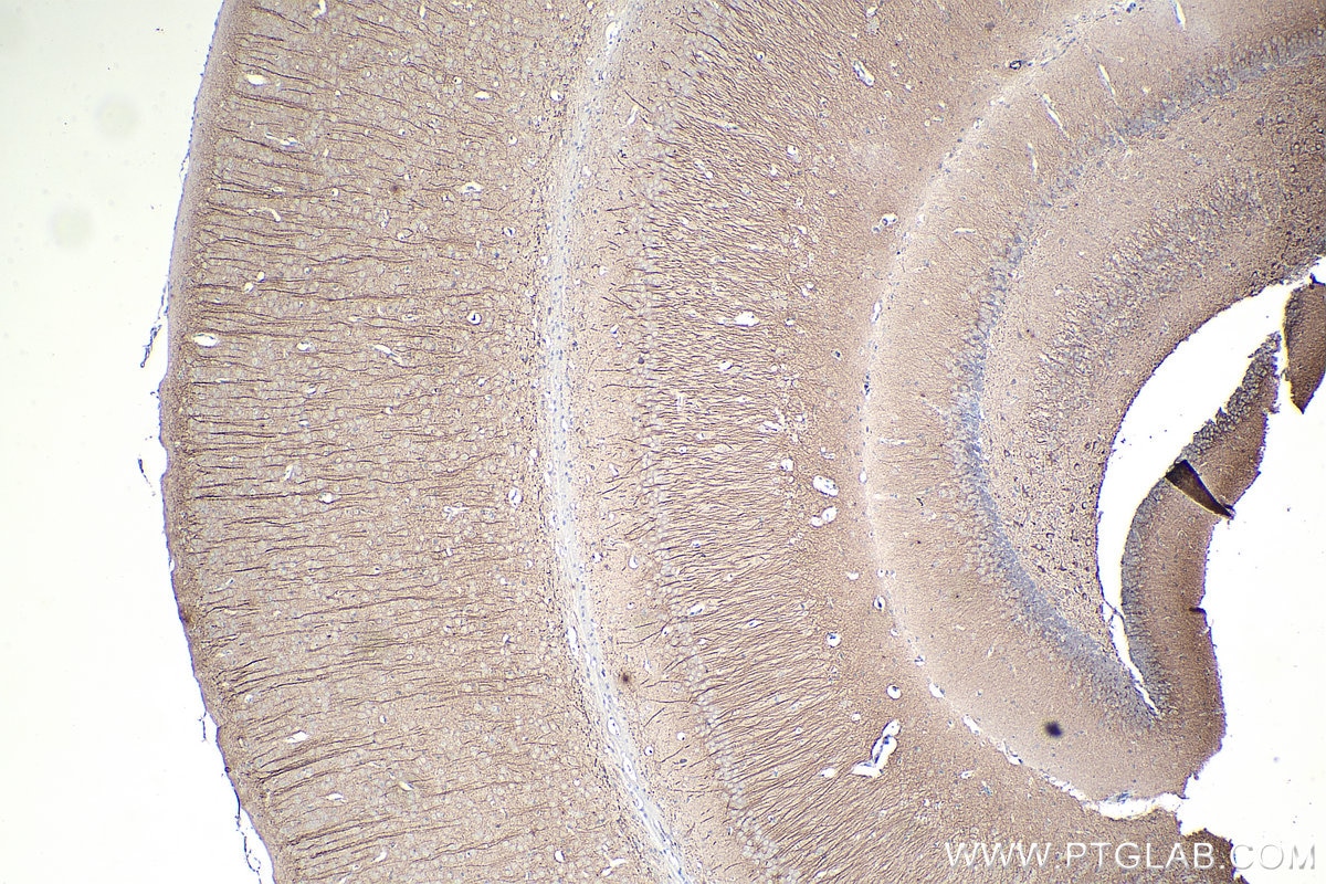 Immunohistochemistry (IHC) staining of mouse brain tissue using MAP2 Monoclonal antibody (67015-1-Ig)