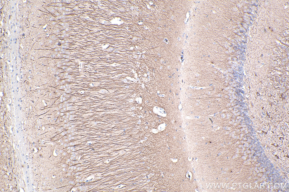 Immunohistochemistry (IHC) staining of mouse brain tissue using MAP2 Monoclonal antibody (67015-1-Ig)
