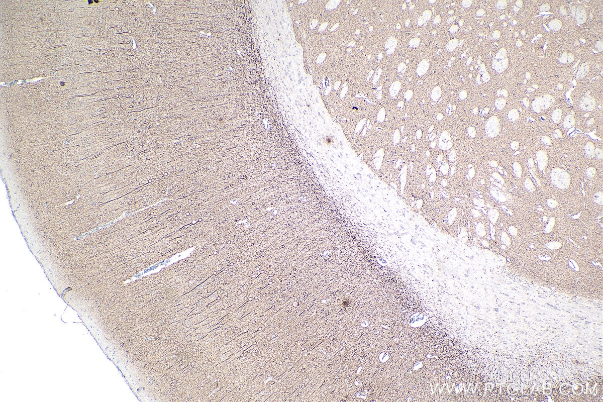 Immunohistochemistry (IHC) staining of rat brain tissue using MAP2 Monoclonal antibody (67015-1-Ig)