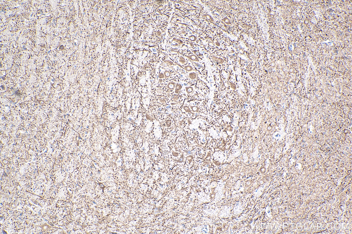 Immunohistochemistry (IHC) staining of mouse cerebellum tissue using MAP2 Monoclonal antibody (67015-1-Ig)
