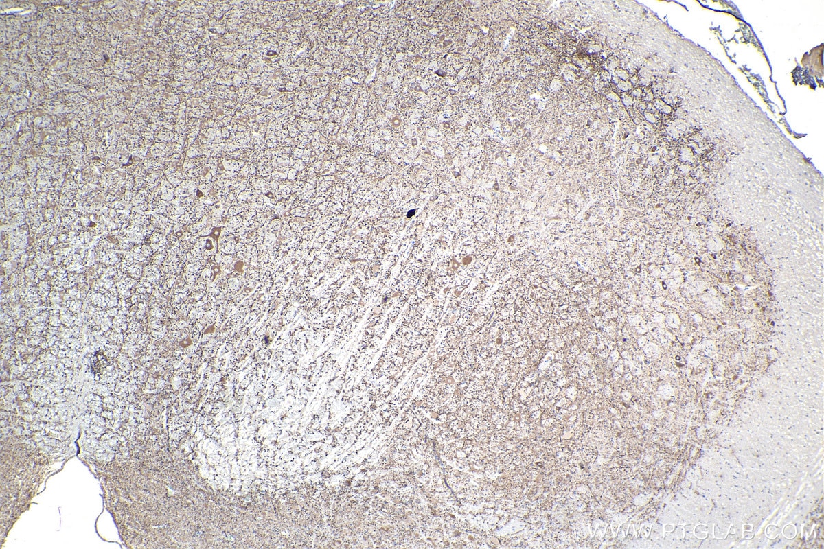 Immunohistochemistry (IHC) staining of rat cerebellum tissue using MAP2 Monoclonal antibody (67015-1-Ig)