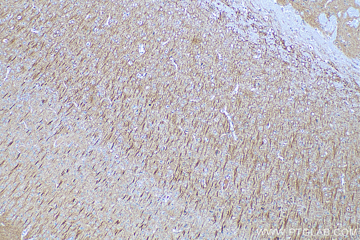 Immunohistochemistry (IHC) staining of mouse brain tissue using MAP2 Monoclonal antibody (67015-1-Ig)