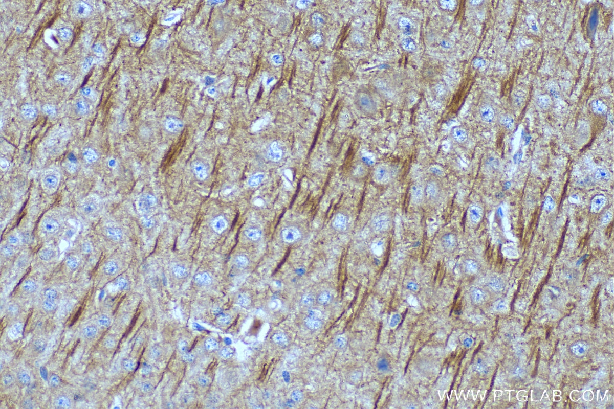 Immunohistochemistry (IHC) staining of mouse brain tissue using MAP2 Monoclonal antibody (67015-1-Ig)