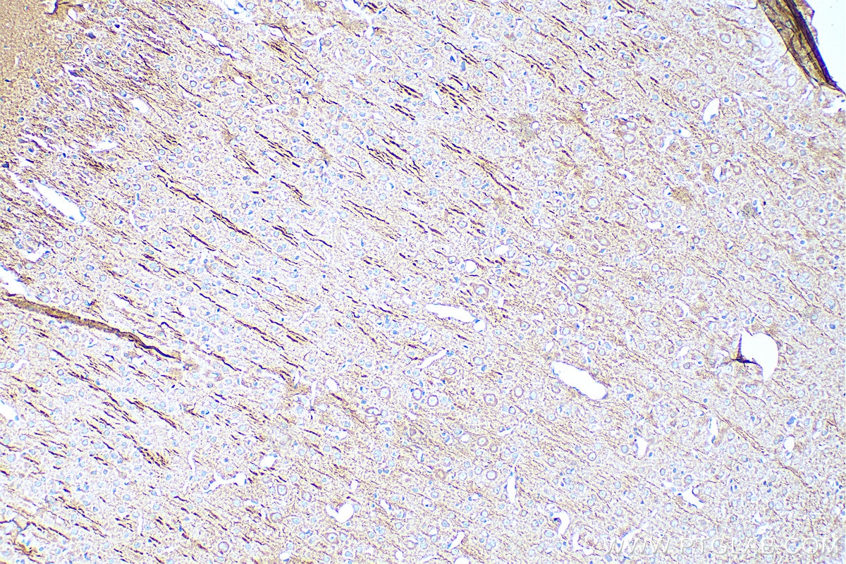 Immunohistochemistry (IHC) staining of rat brain tissue using MAP2 Monoclonal antibody (67015-1-Ig)