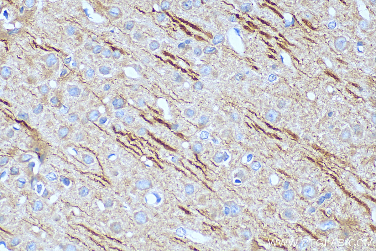 Immunohistochemistry (IHC) staining of rat brain tissue using MAP2 Monoclonal antibody (67015-1-Ig)