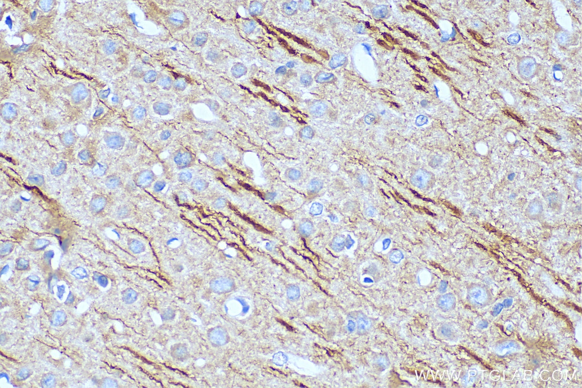 MAP2 antibody (67015-1-Ig) | Proteintech