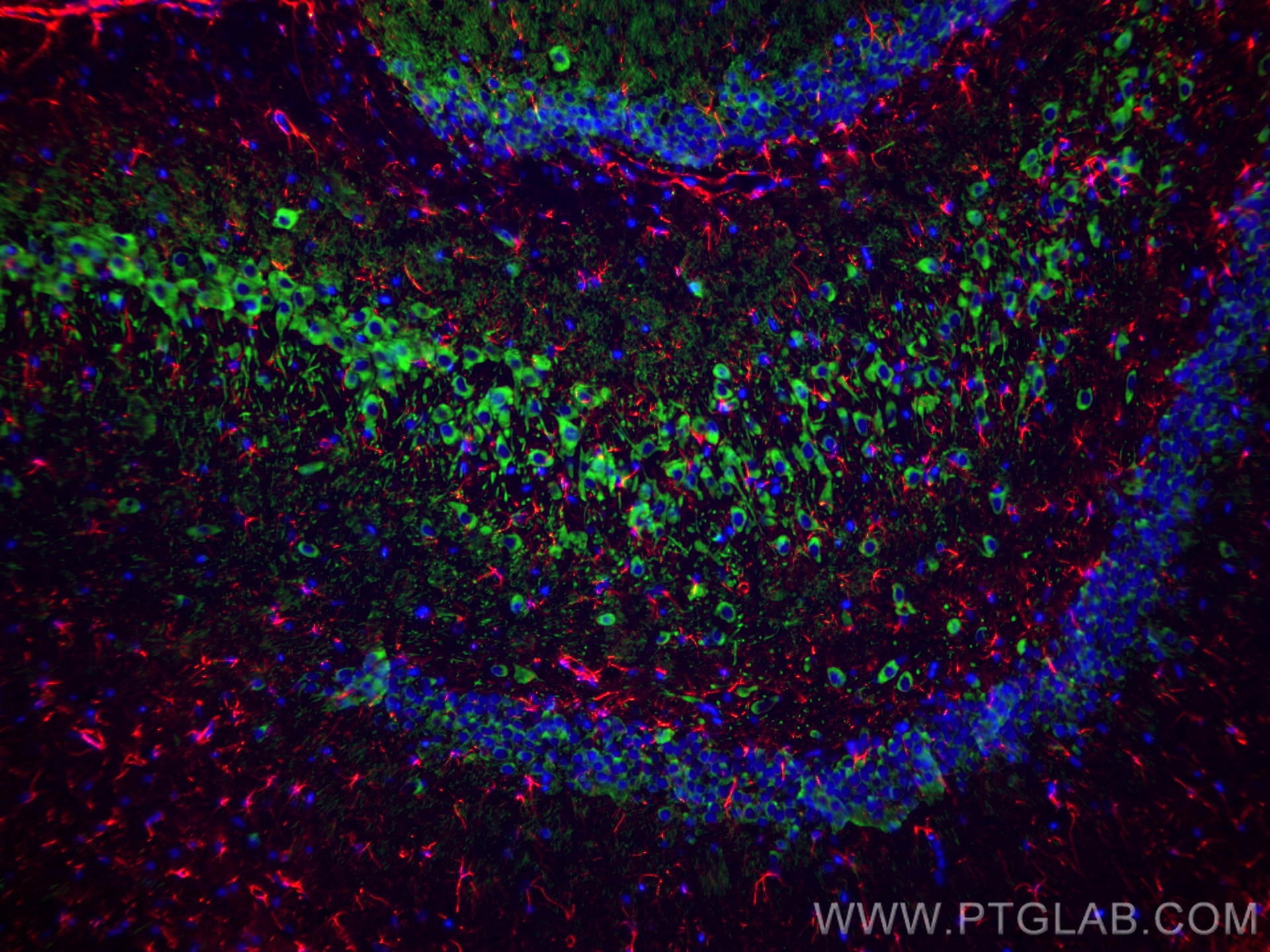 Immunofluorescence (IF) / fluorescent staining of rat brain tissue using MAP2 Recombinant antibody (84306-3-RR)
