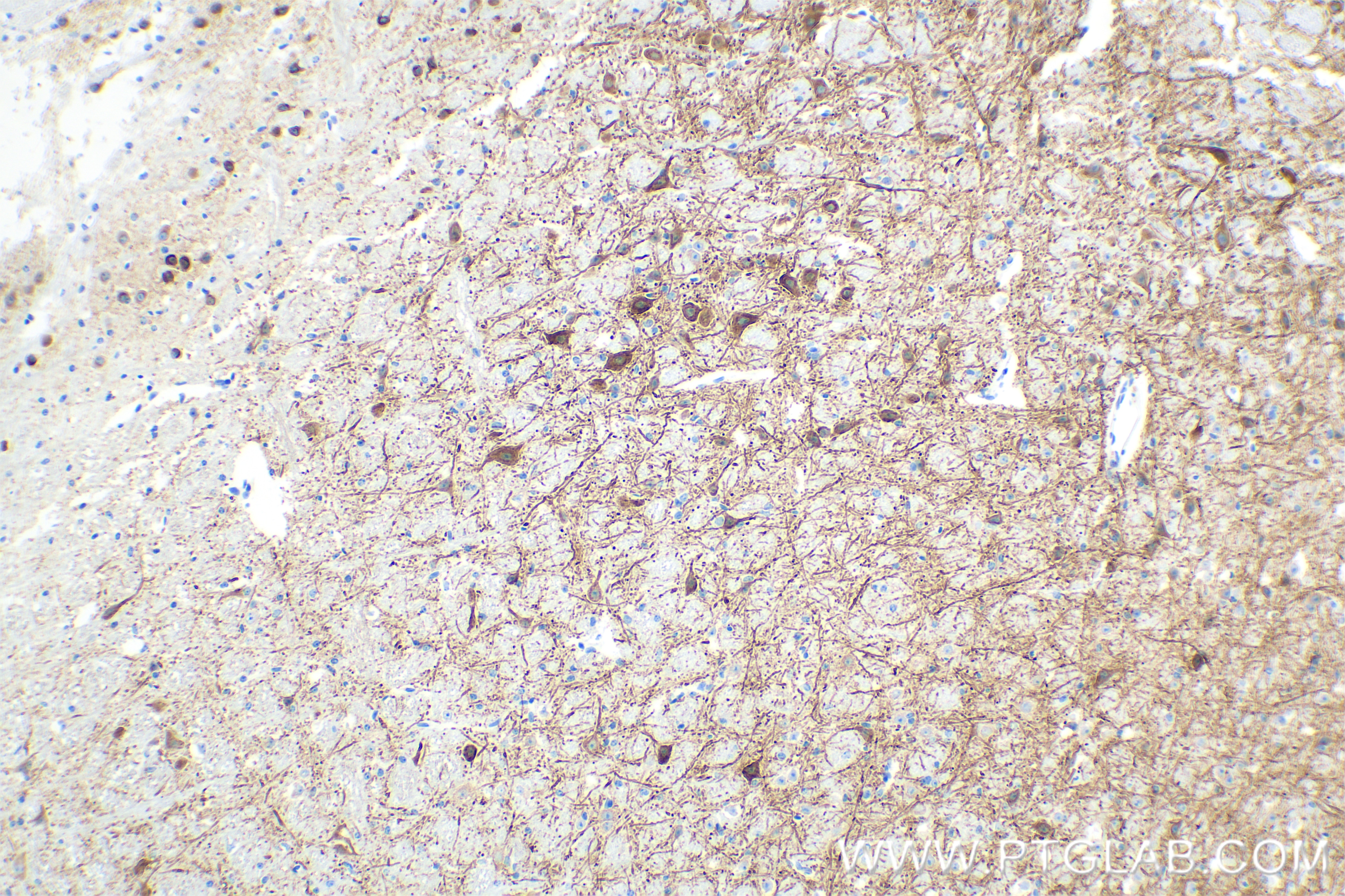 Immunohistochemistry (IHC) staining of mouse cerebellum tissue using MAP2 Recombinant antibody (84306-3-RR)