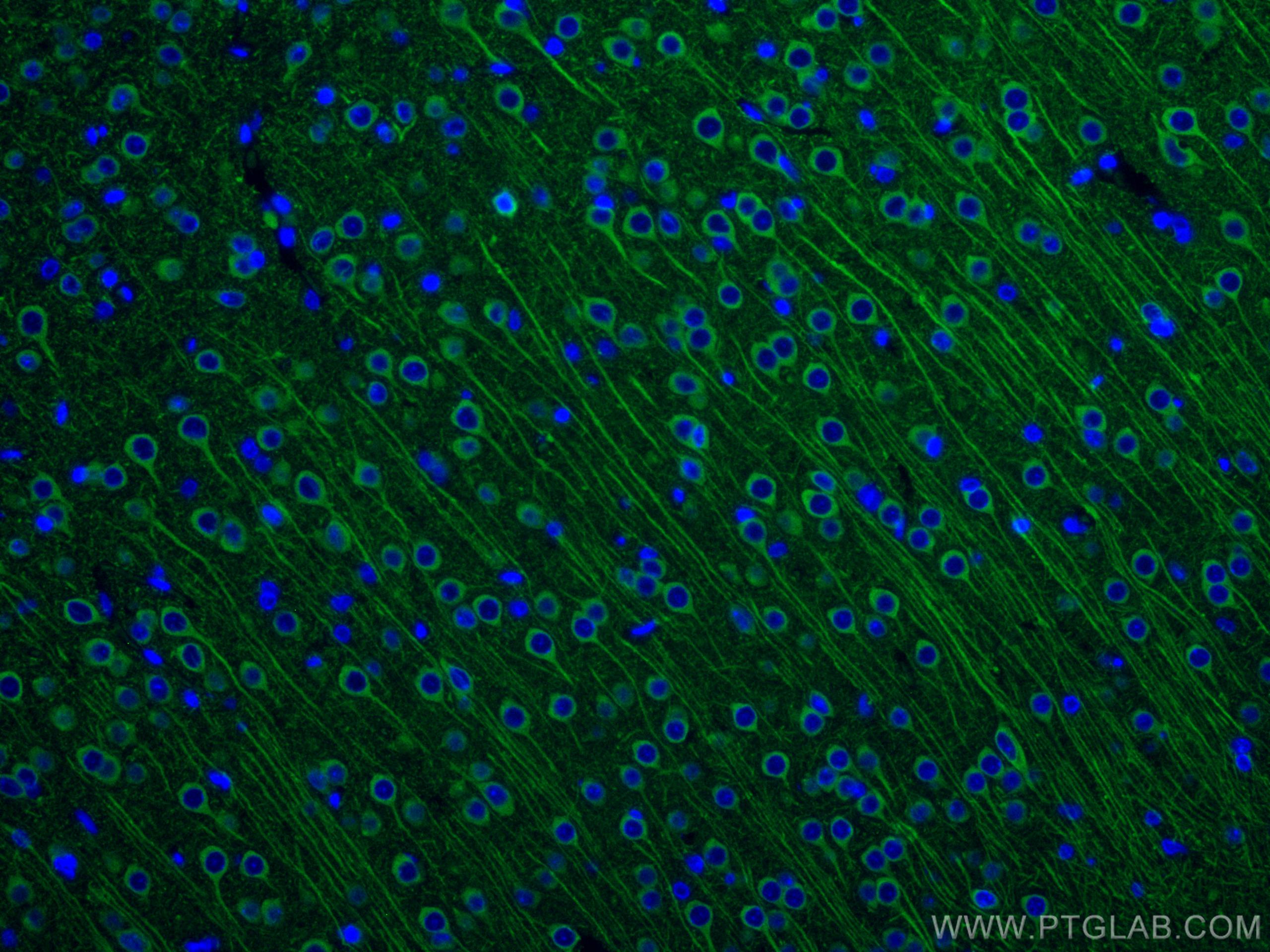 Immunofluorescence (IF) / fluorescent staining of rat brain tissue using CoraLite® Plus 488-conjugated MAP2 Polyclonal anti (CL488-17490)
