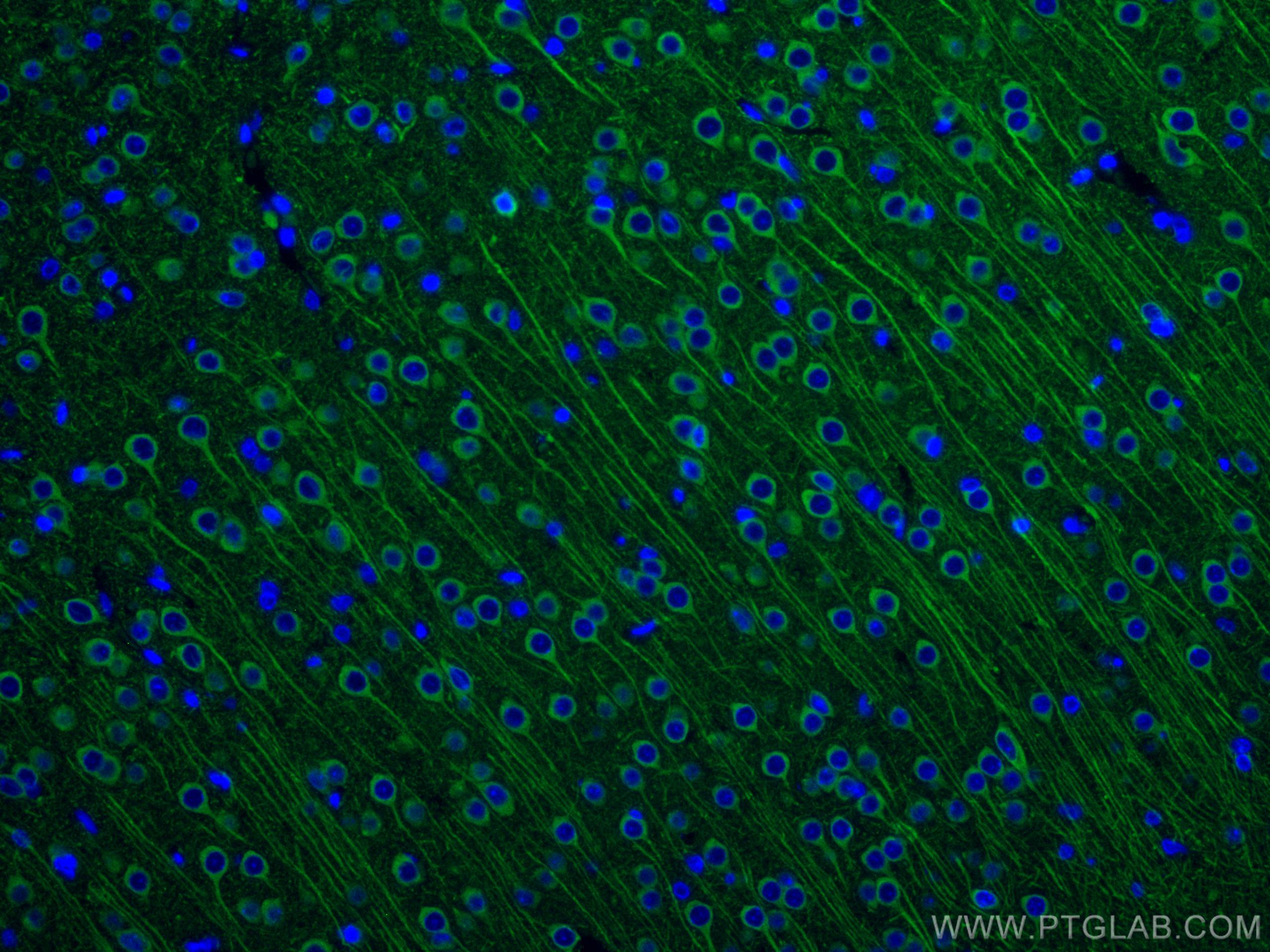 Anti-Brn-2 (POU3F2) Antibody, clone 8C4.2 clone 8C4.2, from mouse