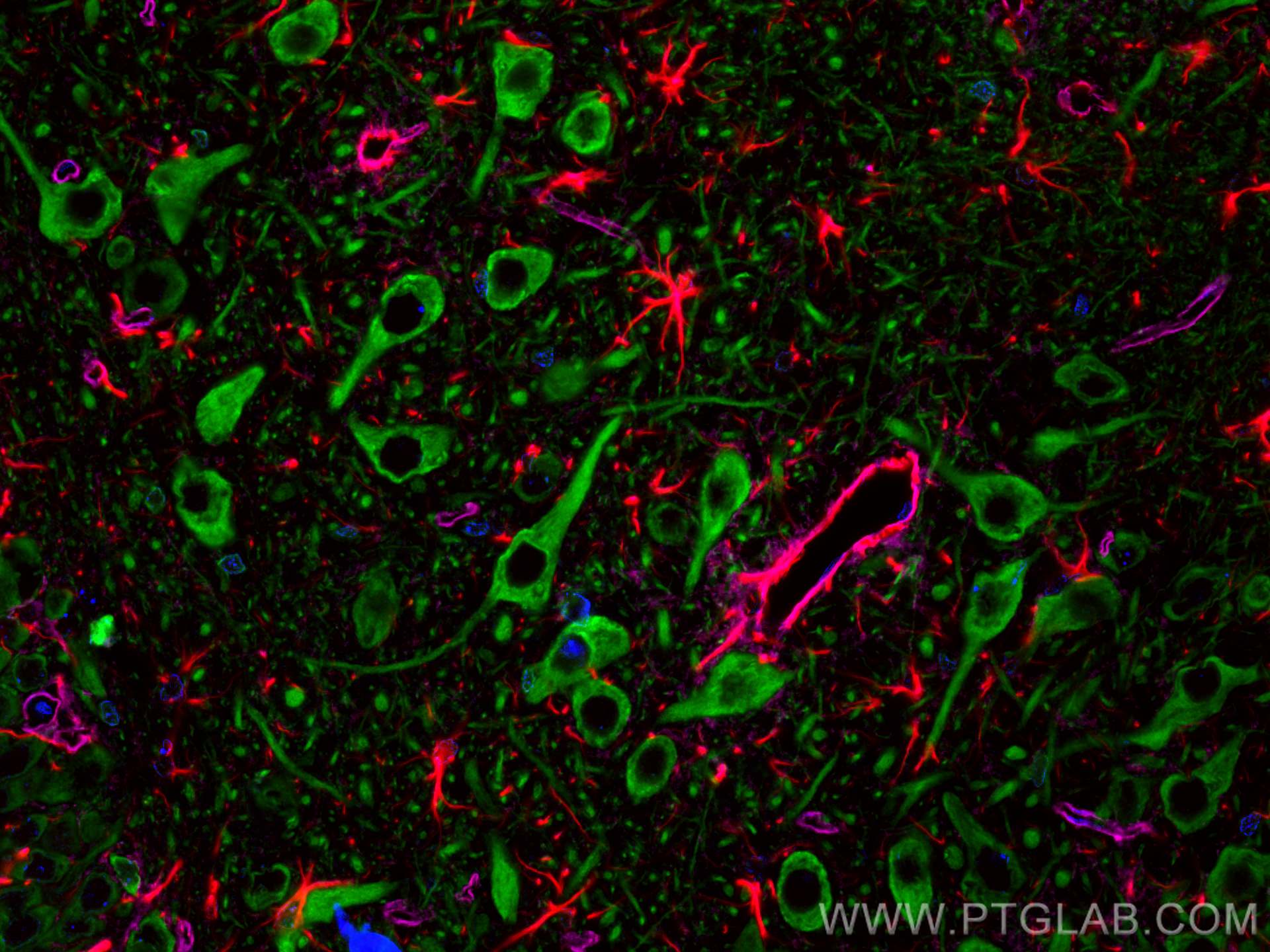 Immunofluorescence (IF) / fluorescent staining of rat brain tissue using CoraLite® Plus 488-conjugated MAP2 Polyclonal anti (CL488-17490)