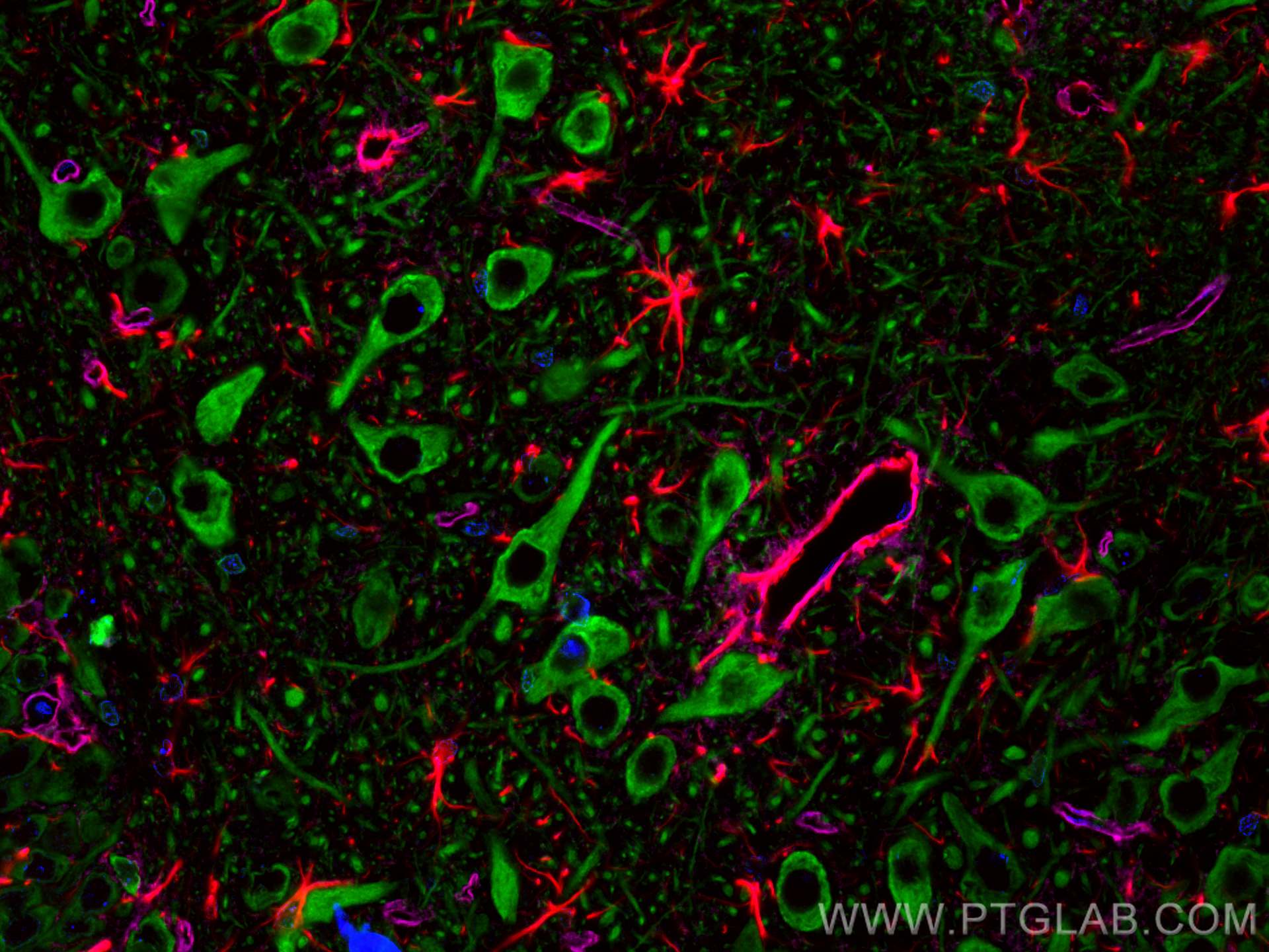 IF Staining of rat brain using CL488-17490