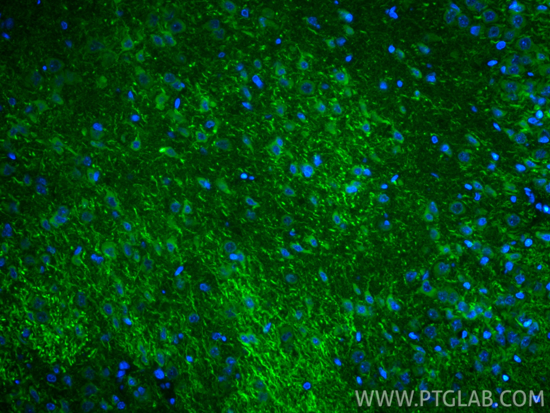Immunofluorescence (IF) / fluorescent staining of rat brain tissue using CoraLite® Plus 488-conjugated MAP2 Recombinant ant (CL488-84306-3)