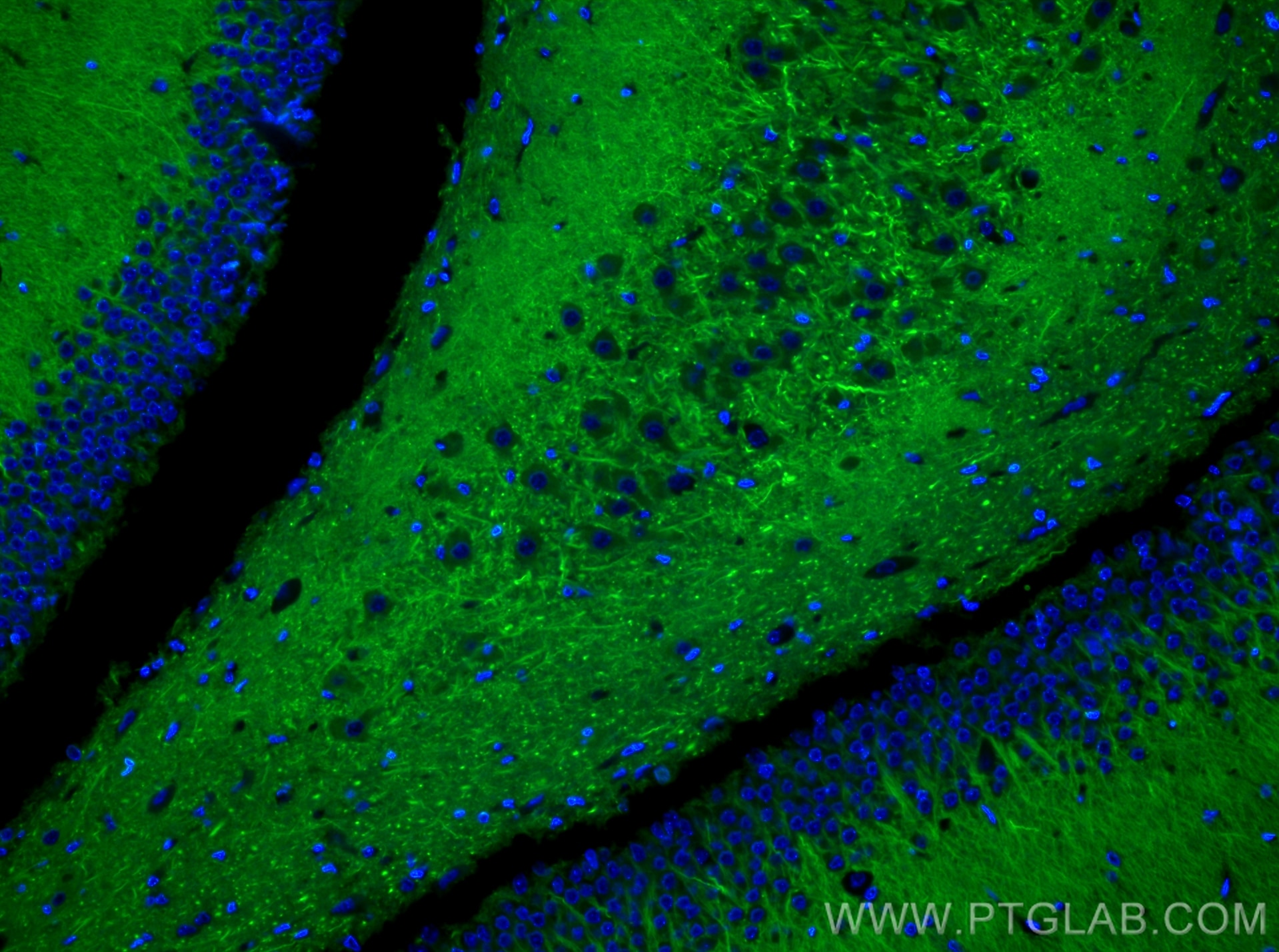 Immunofluorescence (IF) / fluorescent staining of rat brain tissue using CoraLite® Plus 488-conjugated MAP2 Recombinant ant (CL488-84306-4)