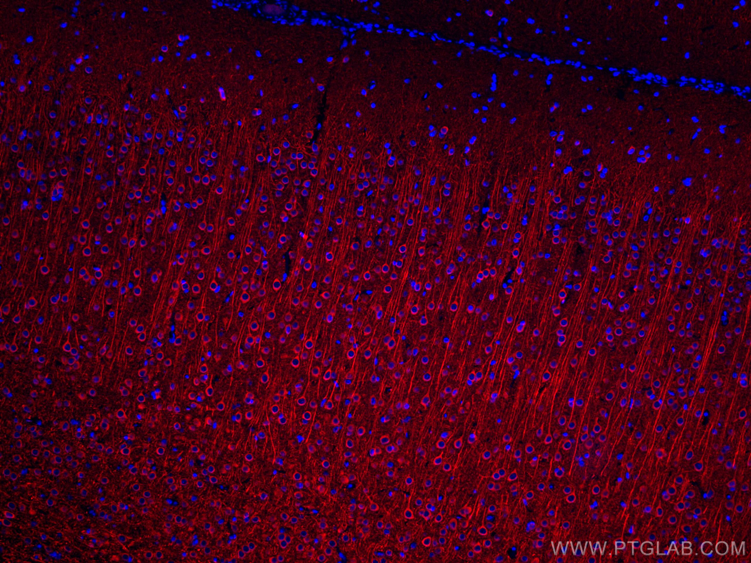 Immunofluorescence (IF) / fluorescent staining of rat brain tissue using CoraLite®594-conjugated MAP2 Polyclonal antibody (CL594-17490)