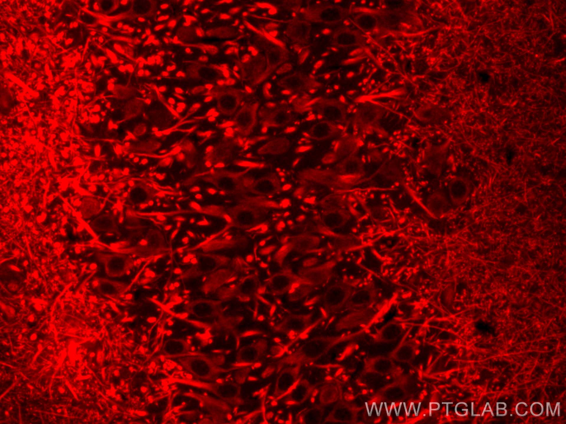 Immunofluorescence (IF) / fluorescent staining of rat brain tissue using CoraLite®594-conjugated MAP2 Monoclonal antibody (CL594-67015)