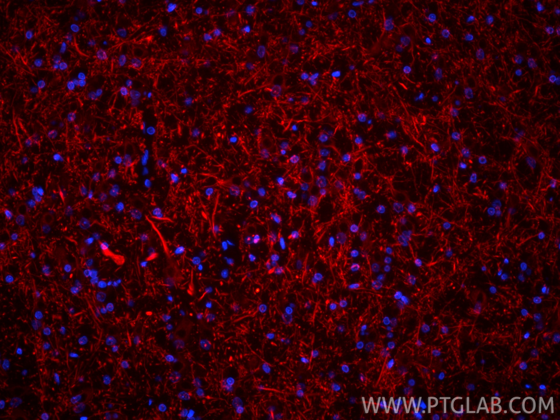Immunofluorescence (IF) / fluorescent staining of rat brain tissue using CoraLite®594-conjugated MAP2 Recombinant antibody (CL594-84306-3)