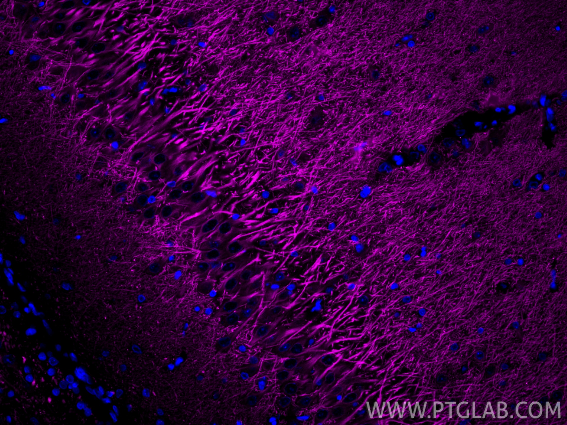 Immunofluorescence (IF) / fluorescent staining of rat brain tissue using CoraLite® Plus 647-conjugated MAP2 Recombinant ant (CL647-84306-3)