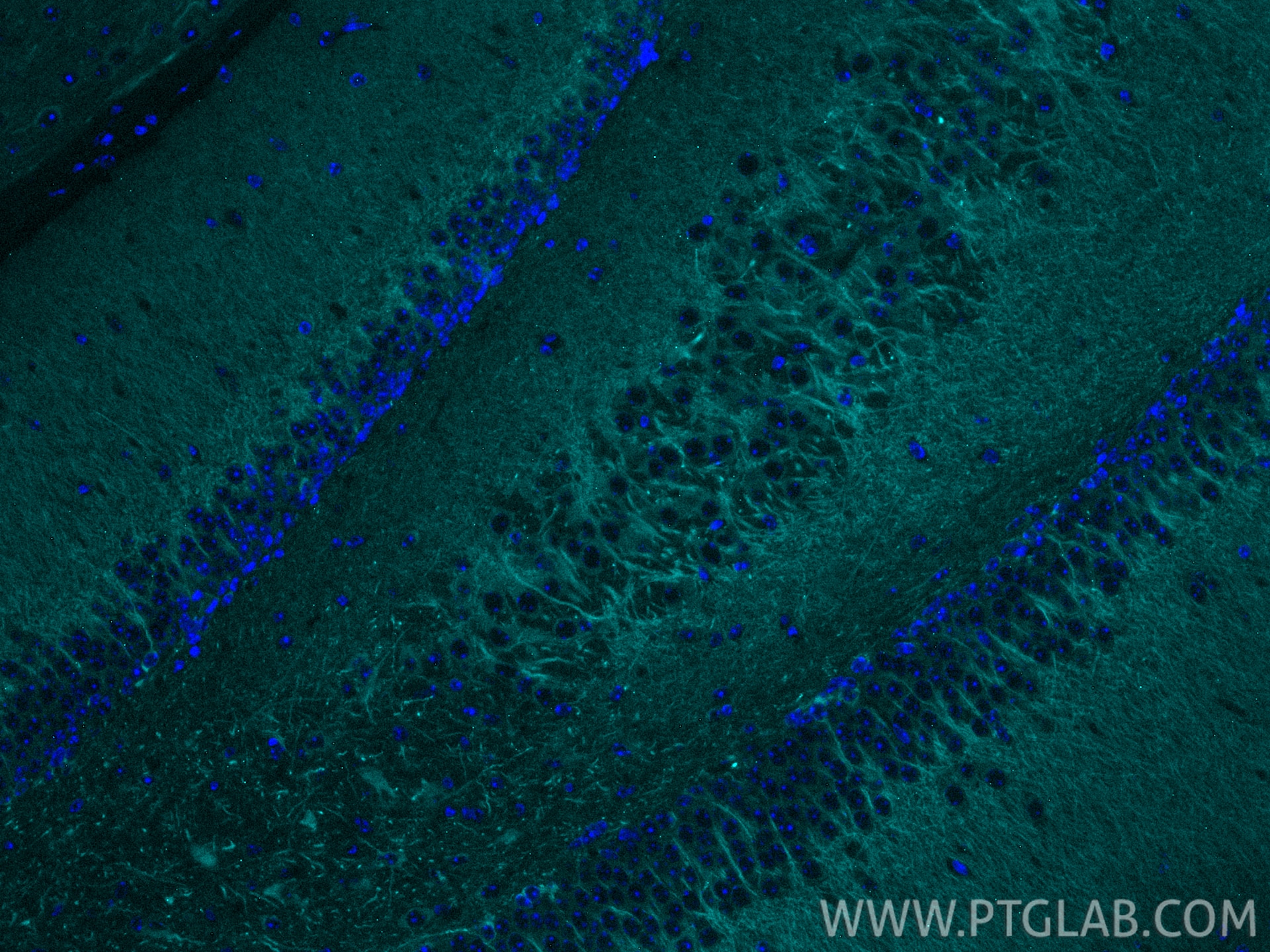 IF Staining of mouse brain using CL750-17490 Immunofluorescence (IF) / fluorescent staining of mouse brain tissue using CoraLite® Plus 750-conjugated MAP2 Polyclonal anti (CL750-17490)