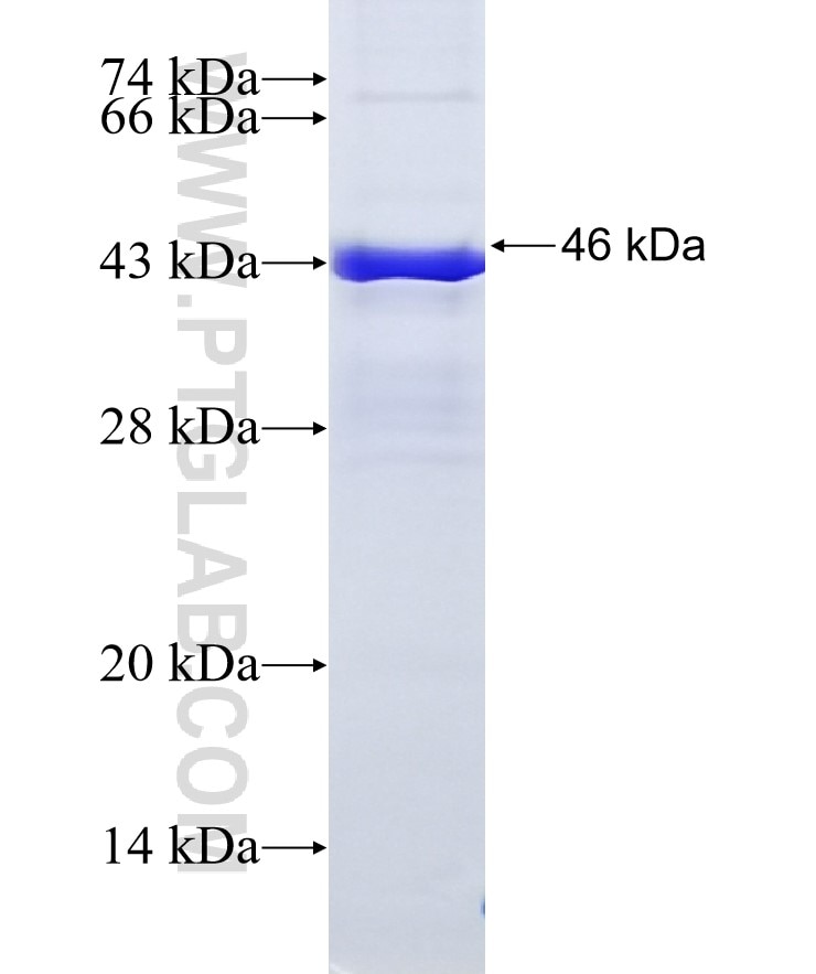 MAP2 fusion protein Ag11349 SDS-PAGE