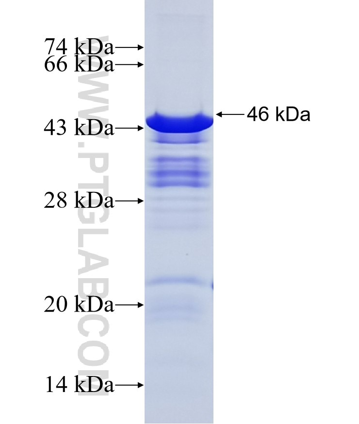 MAP2 fusion protein Ag11349 SDS-PAGE