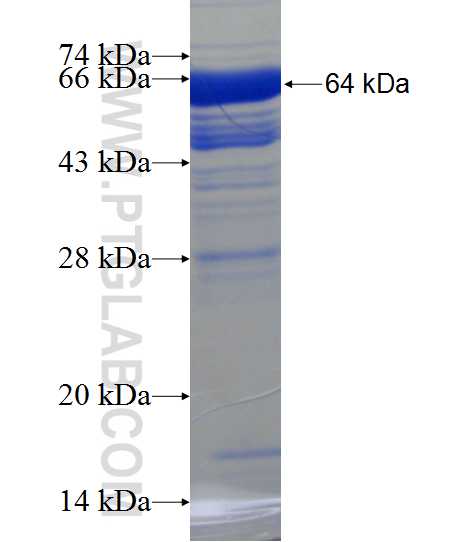 MAP2 fusion protein Ag11580 SDS-PAGE
