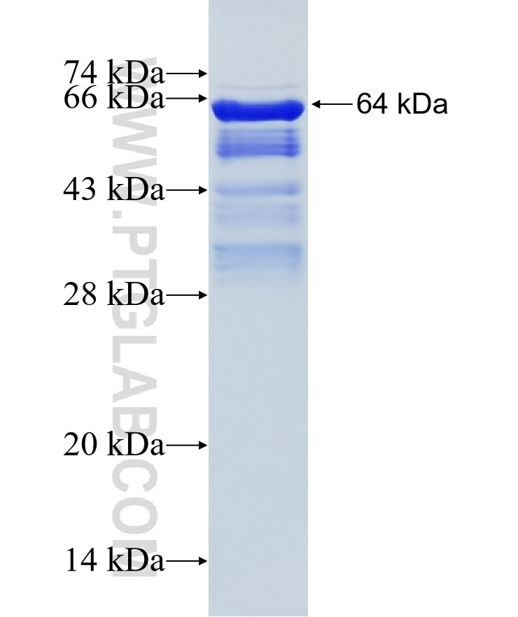 MAP2 fusion protein Ag11580 SDS-PAGE