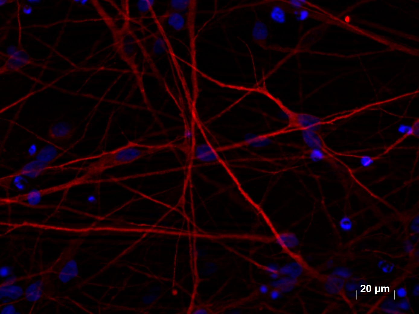 Immunofluorescence (IF) / fluorescent staining of iPS cells using MAP2 Polyclonal antibody (17490-1-AP)