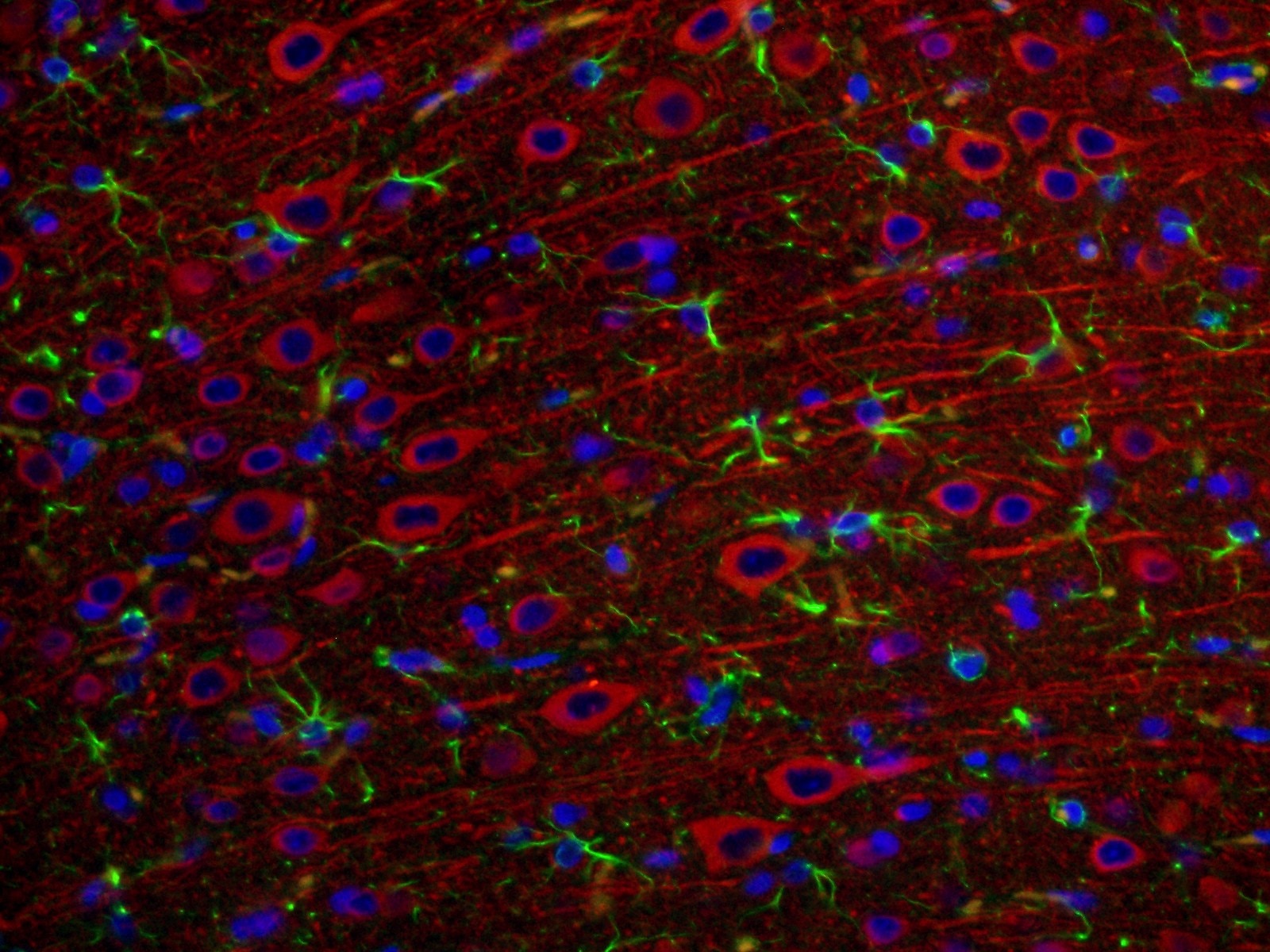 IF Staining of rat brain using 17490-1-AP